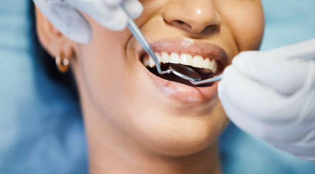 Best Emergency Root Canal Therapy in Madison, NE